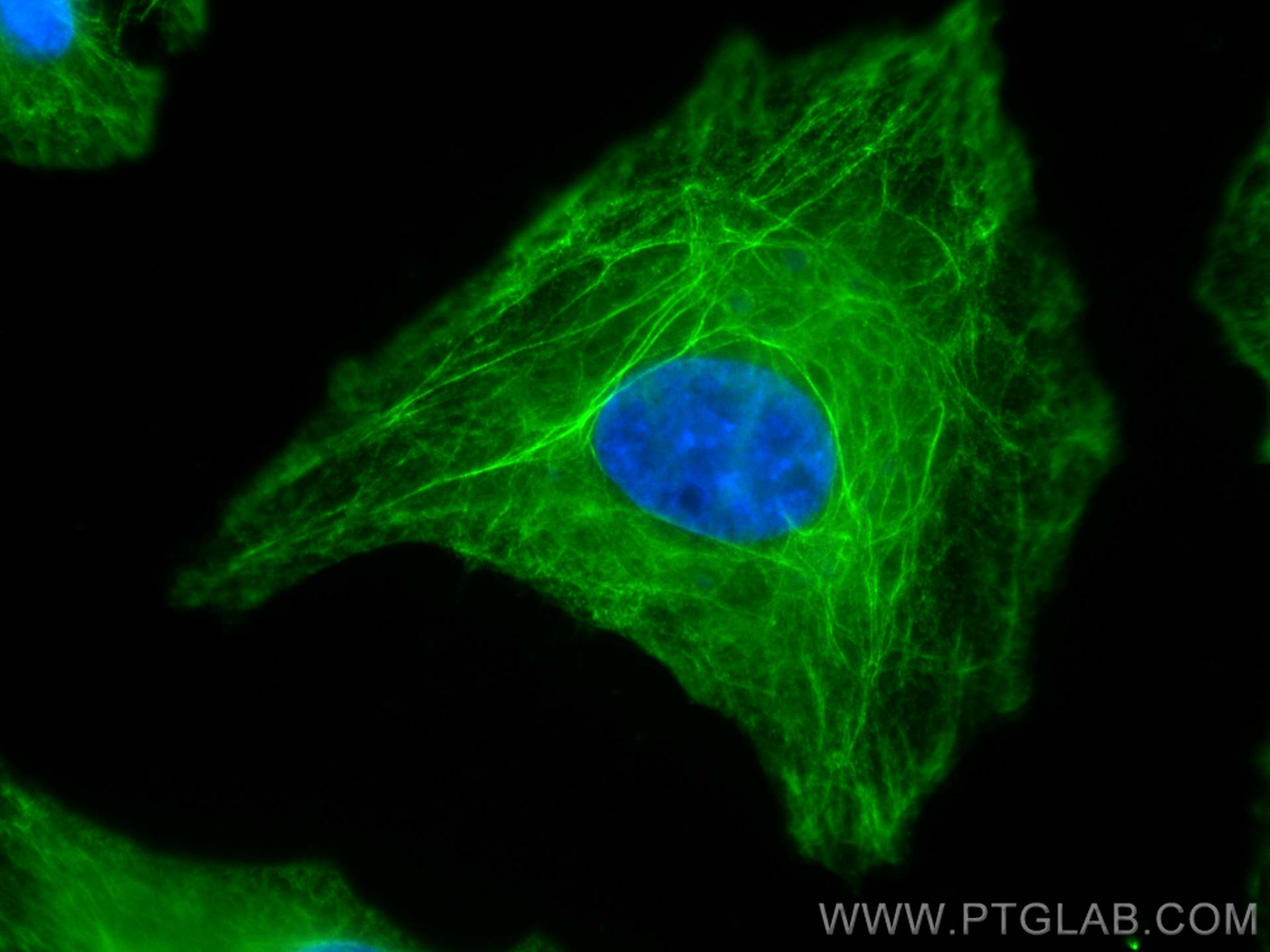 Immunofluorescence (IF) / fluorescent staining of A549 cells using CoraLite® Plus 488-conjugated LASP1 Monoclonal ant (CL488-68080)