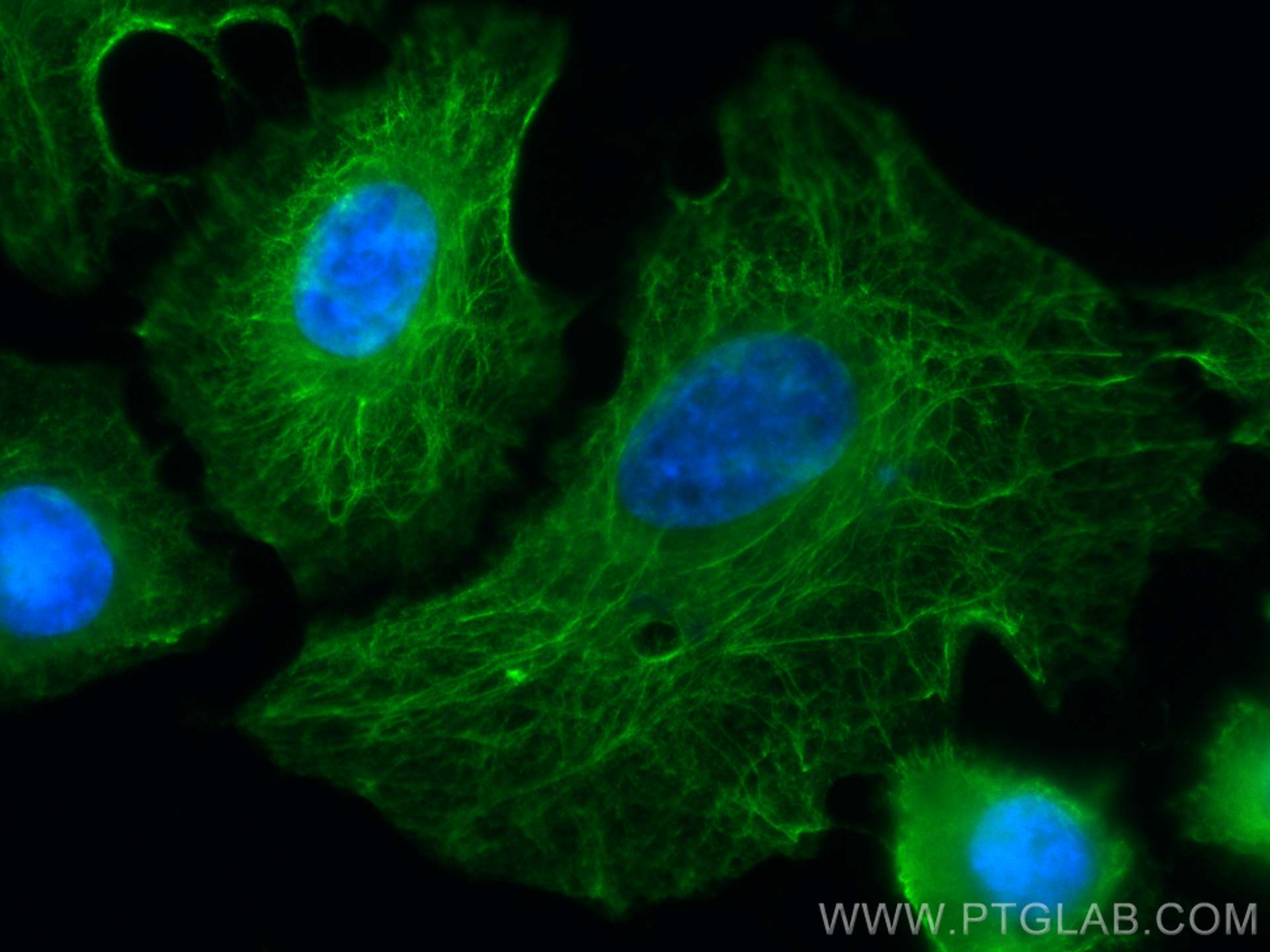 Immunofluorescence (IF) / fluorescent staining of A549 cells using CoraLite® Plus 488-conjugated LASP1 Monoclonal ant (CL488-68080)