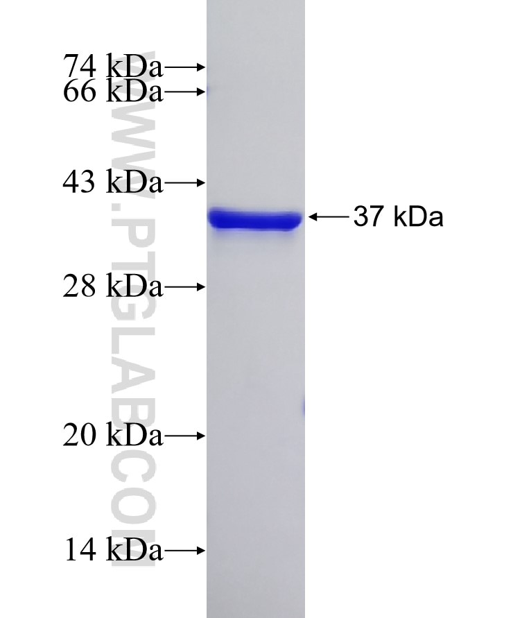LASP1 fusion protein Ag0800 SDS-PAGE