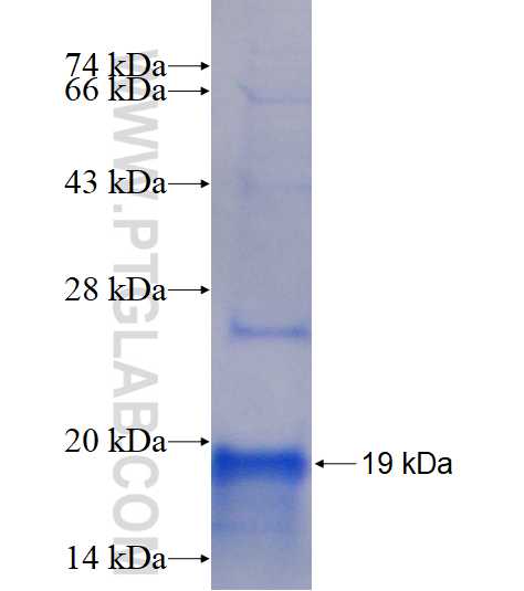 LASP1 fusion protein Ag18101 SDS-PAGE