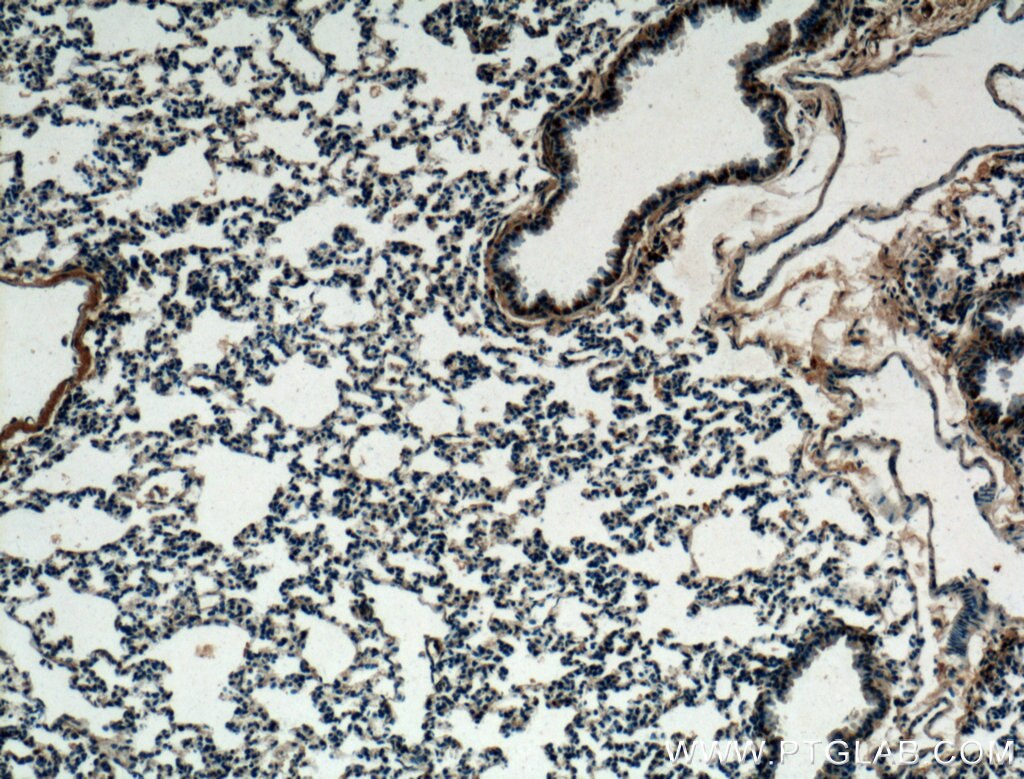 Immunohistochemistry (IHC) staining of mouse lung tissue using LASS2 Polyclonal antibody (20344-1-AP)