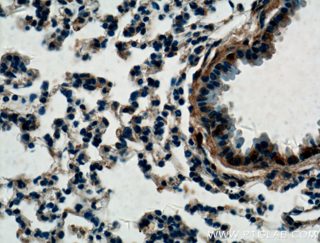 Immunohistochemistry (IHC) staining of mouse lung tissue using LASS2 Polyclonal antibody (20344-1-AP)