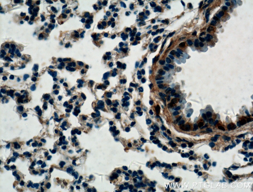 IHC staining of mouse lung using 20344-1-AP