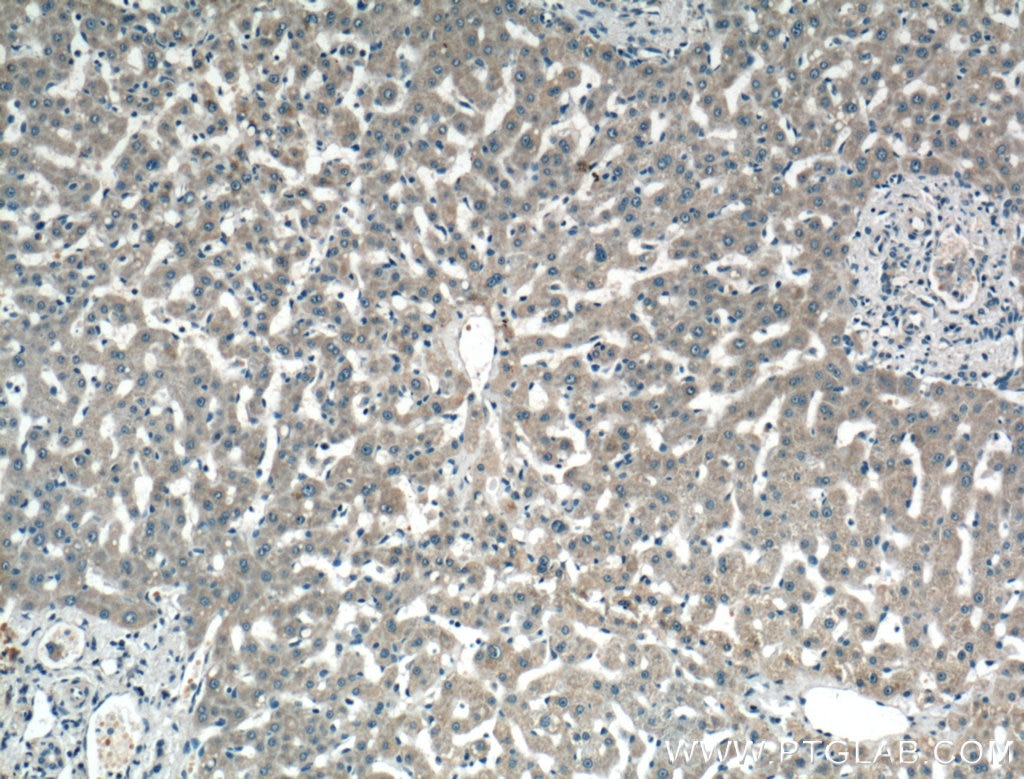 Immunohistochemistry (IHC) staining of human liver tissue using LASS2 Polyclonal antibody (20344-1-AP)