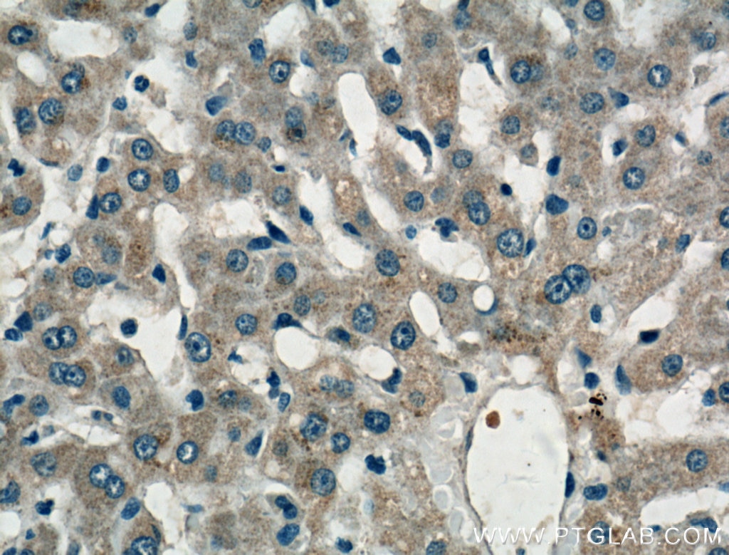 Immunohistochemistry (IHC) staining of human liver tissue using LASS2 Polyclonal antibody (20344-1-AP)