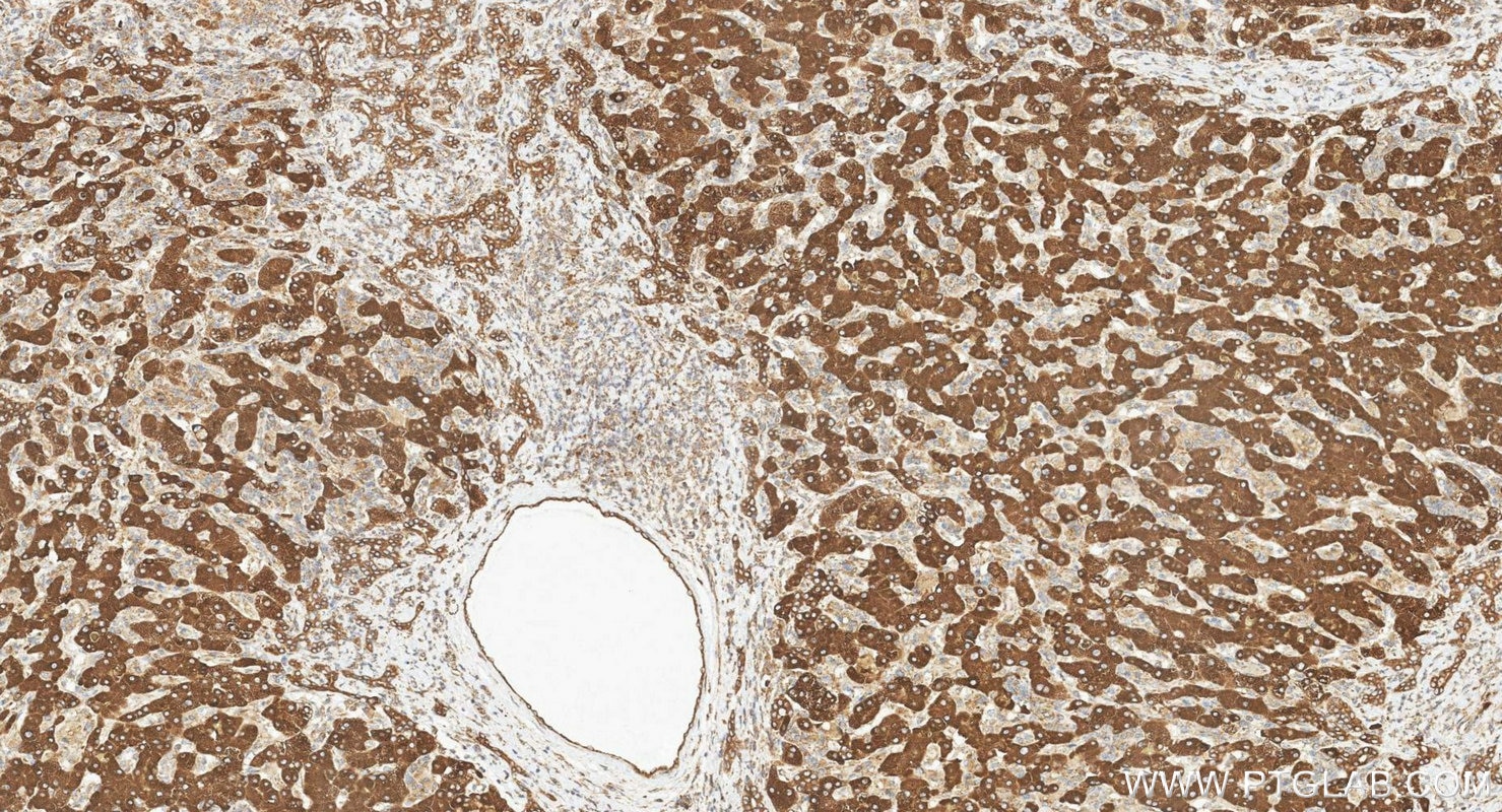 Immunohistochemistry (IHC) staining of human liver tissue using LASS2 Polyclonal antibody (20344-1-AP)
