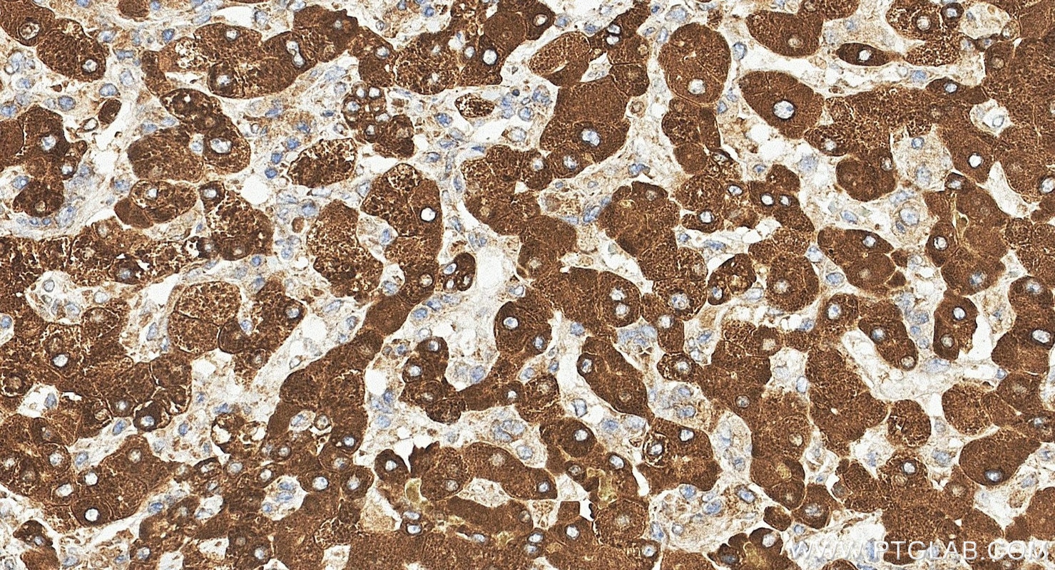Immunohistochemistry (IHC) staining of human liver tissue using LASS2 Polyclonal antibody (20344-1-AP)