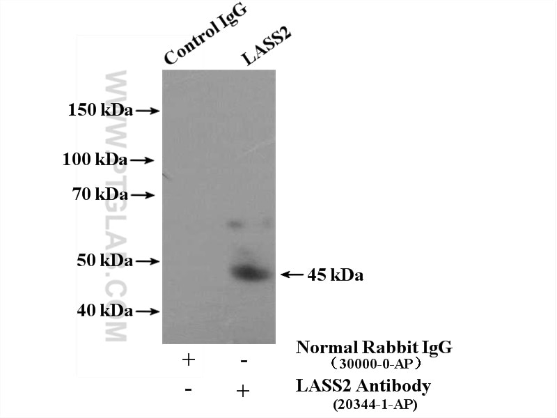Immunoprecipitation (IP) experiment of HeLa cells using LASS2 Polyclonal antibody (20344-1-AP)