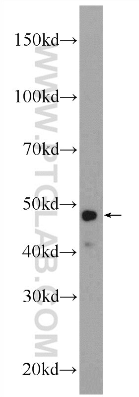 Western Blot (WB) analysis of HeLa cells using LASS2 Polyclonal antibody (20344-1-AP)