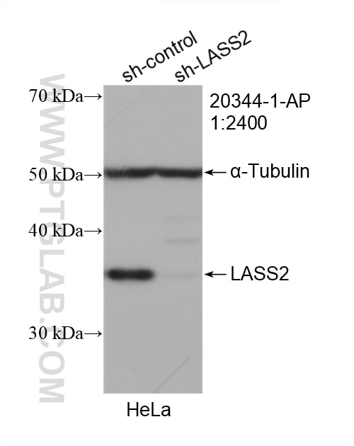 Western Blot (WB) analysis of HeLa cells using LASS2 Polyclonal antibody (20344-1-AP)