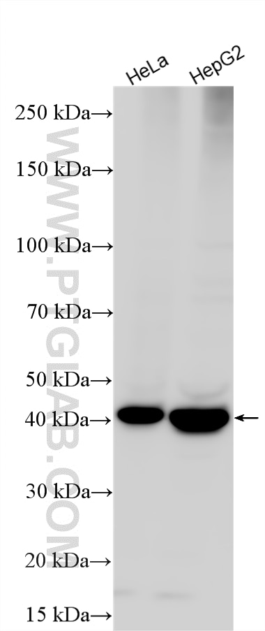 WB analysis using 20344-1-AP Western Blot (WB) analysis of various lysates using LASS2 Polyclonal antibody (20344-1-AP)