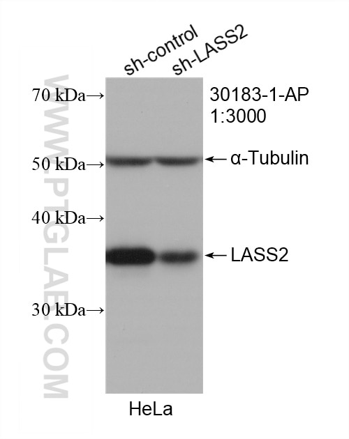Western Blot (WB) analysis of HeLa cells using LASS2 Polyclonal antibody (30183-1-AP)