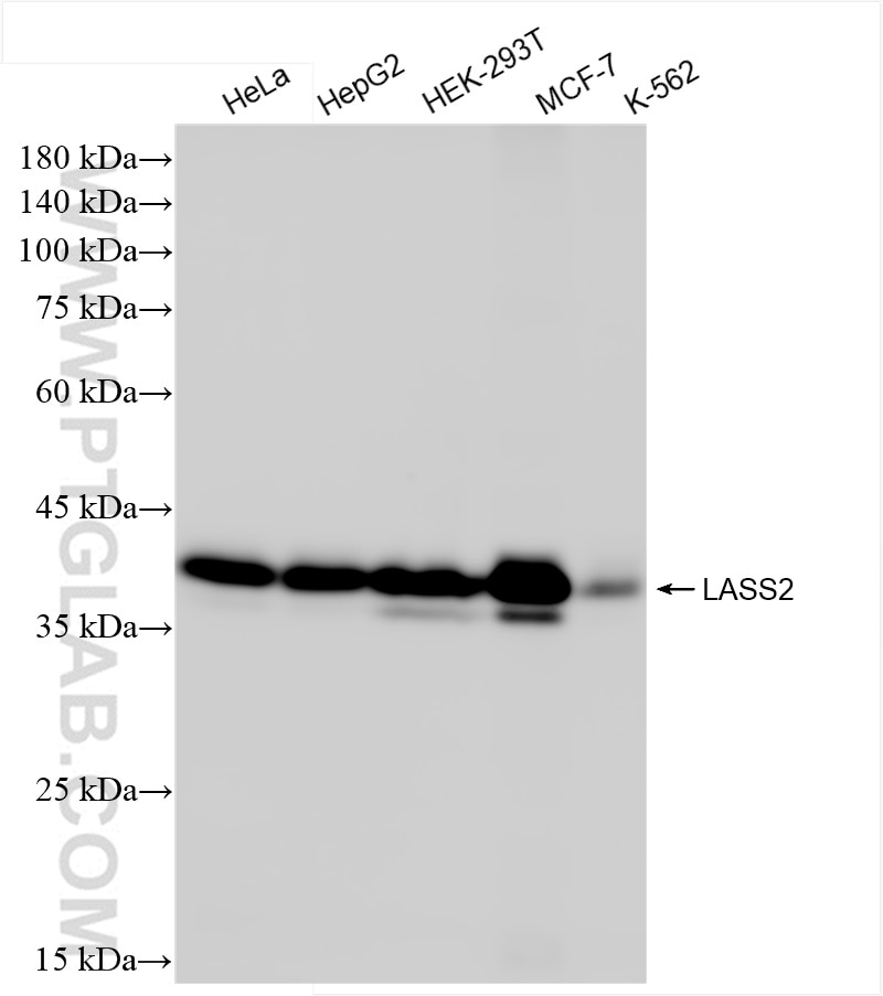 Western Blot (WB) analysis of various lysates using LASS2 Recombinant antibody (84514-4-RR)