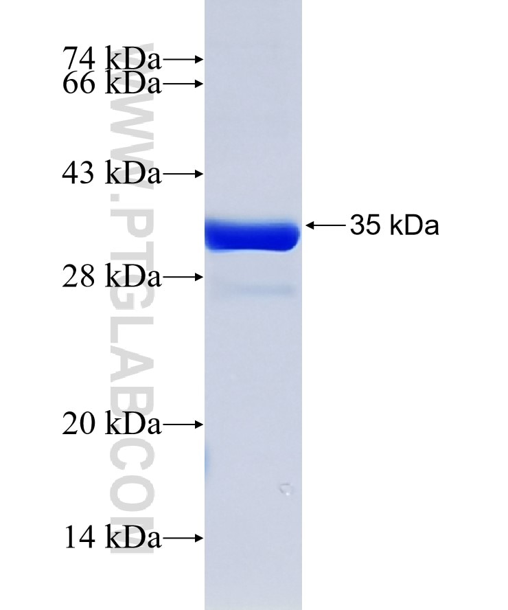 LASS2 fusion protein Ag32769 SDS-PAGE
