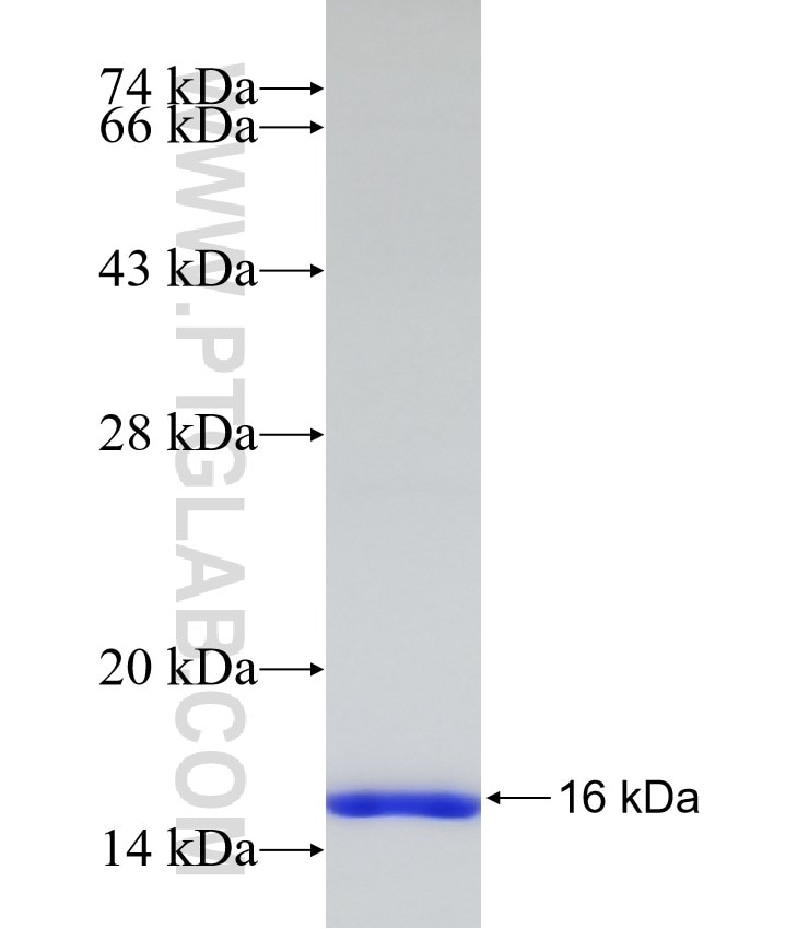 LASS2 fusion protein Ag32797 SDS-PAGE LASS2 fusion protein Ag32797 SDS-PAGE