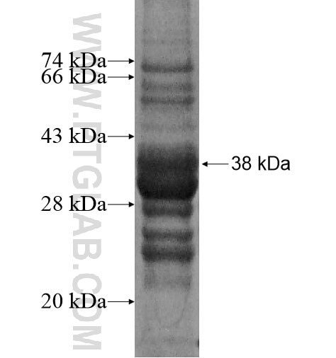 LASS3 fusion protein Ag14099 SDS-PAGE