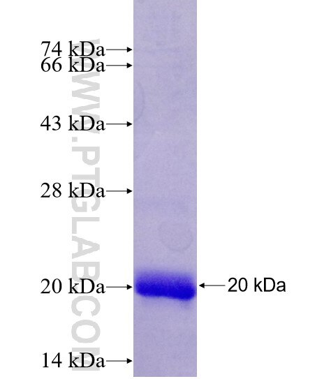 LASS5 fusion protein Ag26160 SDS-PAGE