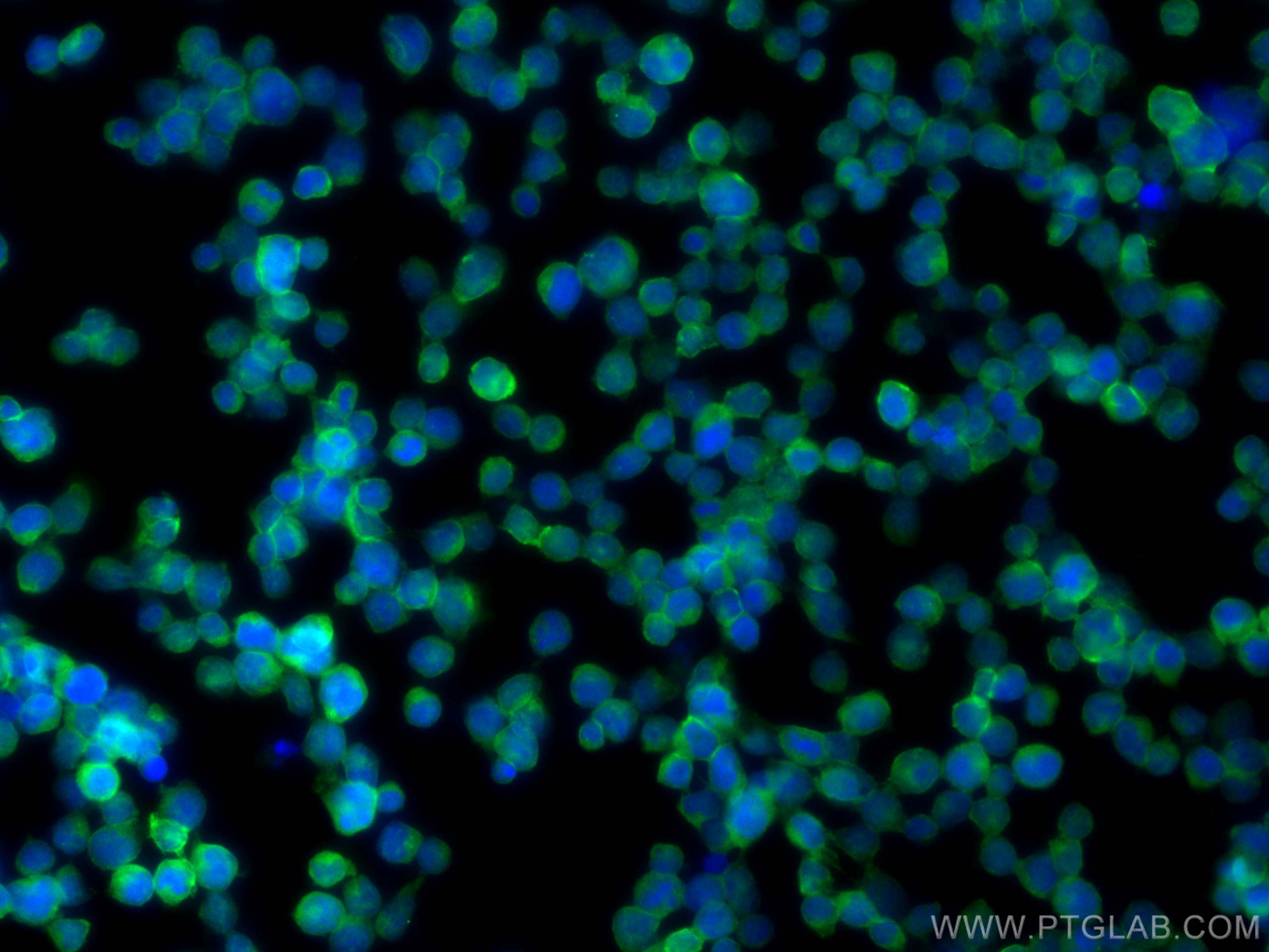 Immunofluorescence (IF) / fluorescent staining of Jurkat cells using LAT Polyclonal antibody (11326-1-AP)