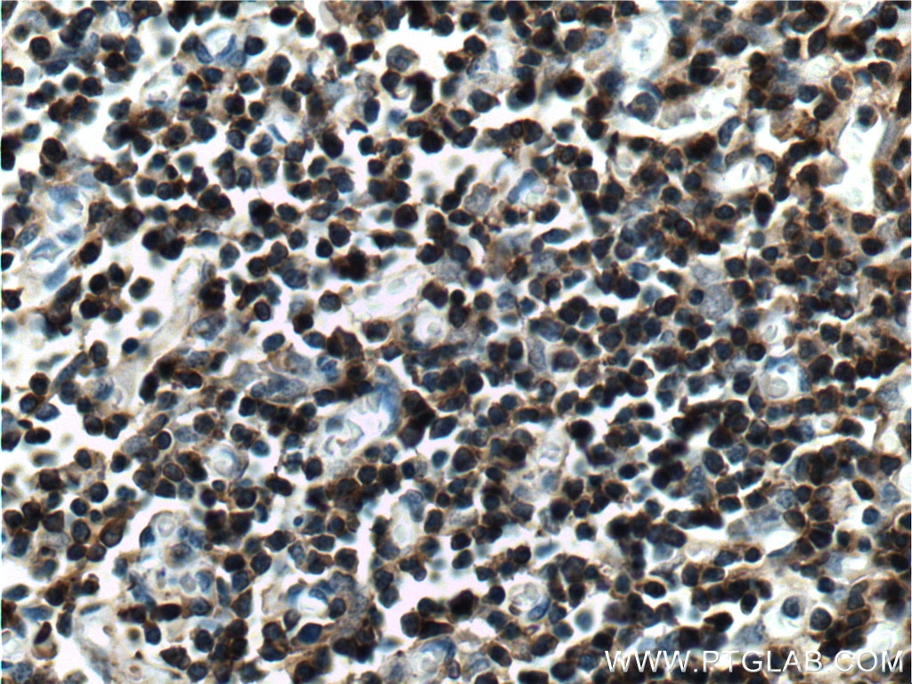 Immunohistochemistry (IHC) staining of human thymus tissue using LAT Polyclonal antibody (11326-1-AP)