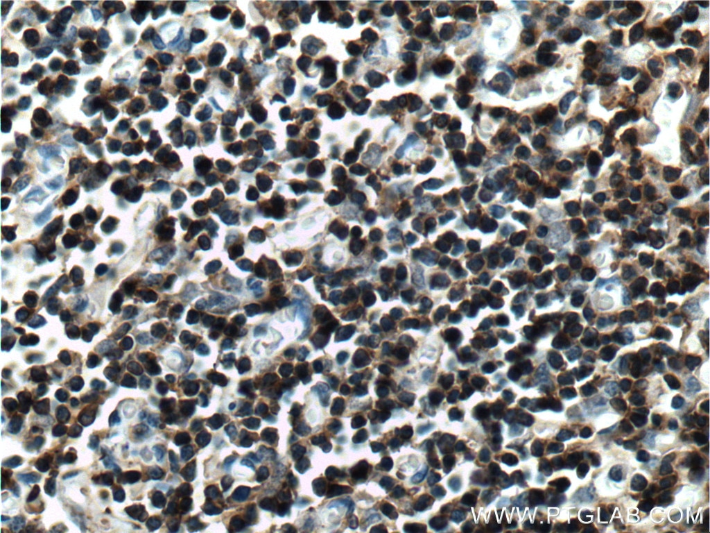 IHC staining of human thymus using 11326-1-AP