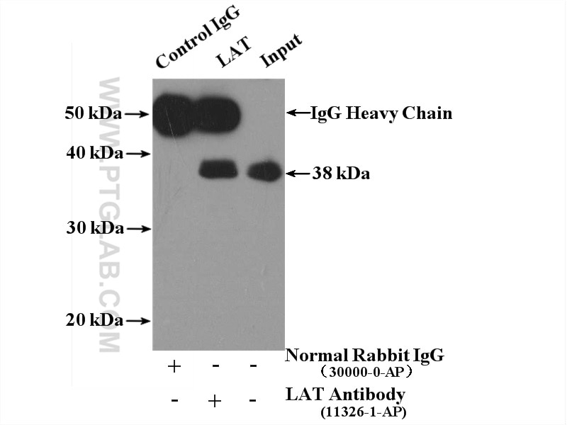 Immunoprecipitation (IP) experiment of Jurkat cells using LAT Polyclonal antibody (11326-1-AP)