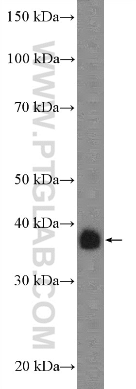 Western Blot (WB) analysis of Jurkat cells using LAT Polyclonal antibody (11326-1-AP)