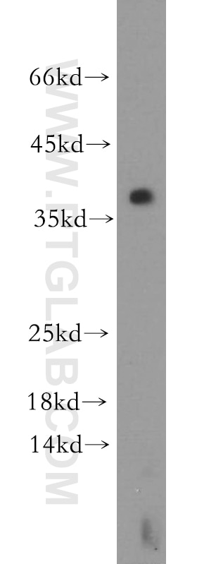 Western Blot (WB) analysis of mouse thymus tissue using LAT Polyclonal antibody (11326-1-AP)