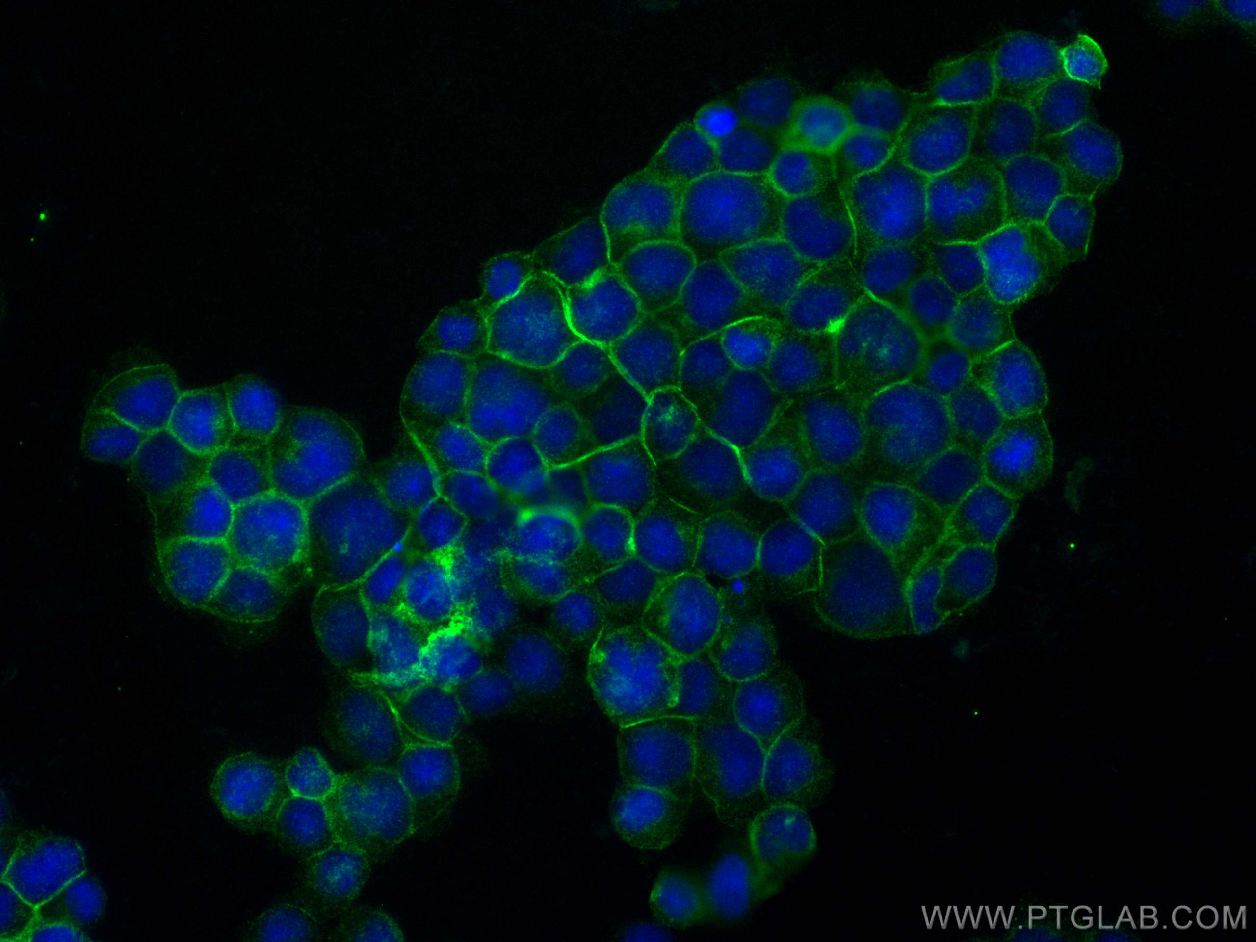 Immunofluorescence (IF) / fluorescent staining of Jurkat cells using LAT Recombinant antibody (82901-1-RR)