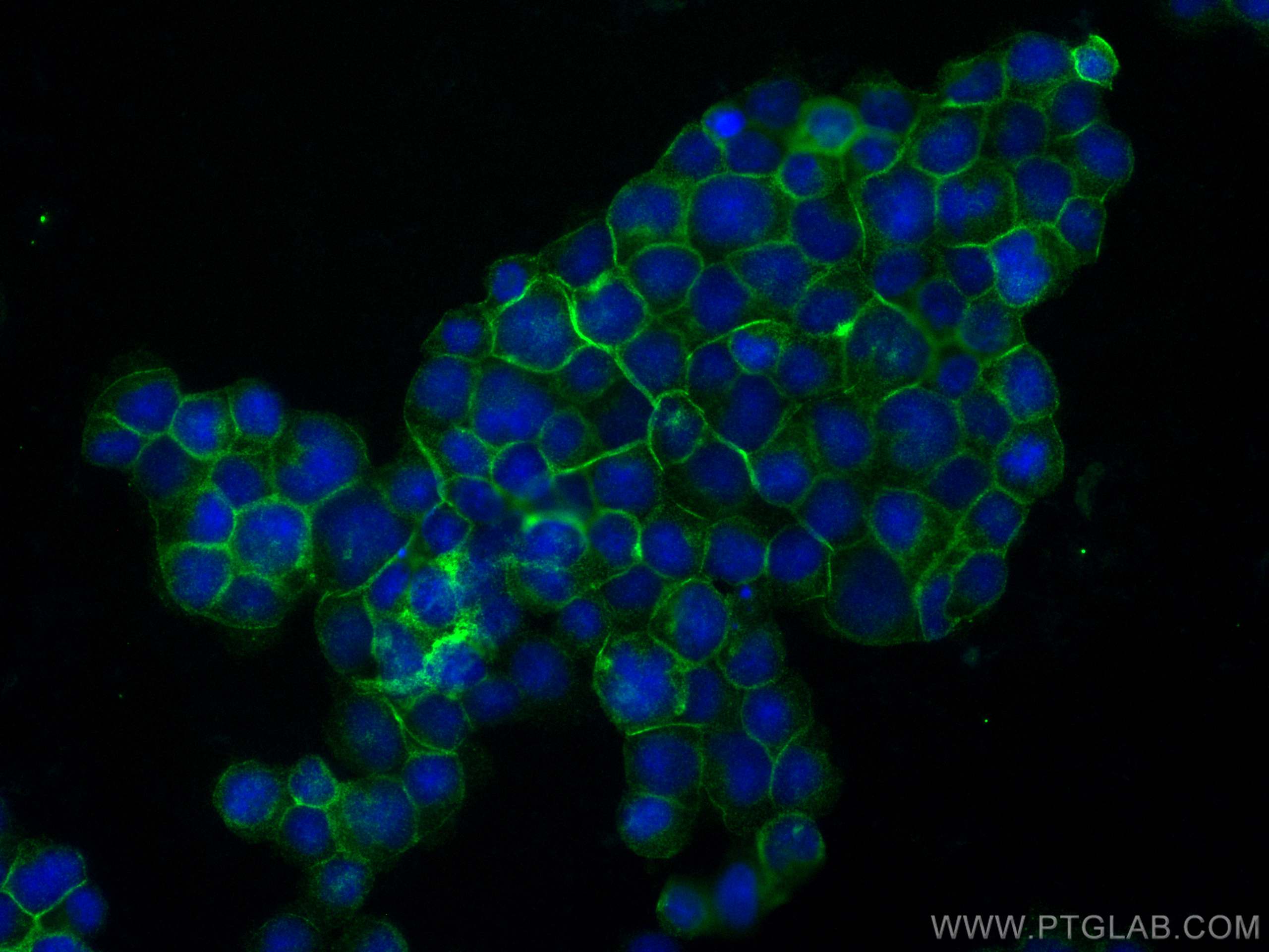 IF Staining of Jurkat using 82901-1-RR