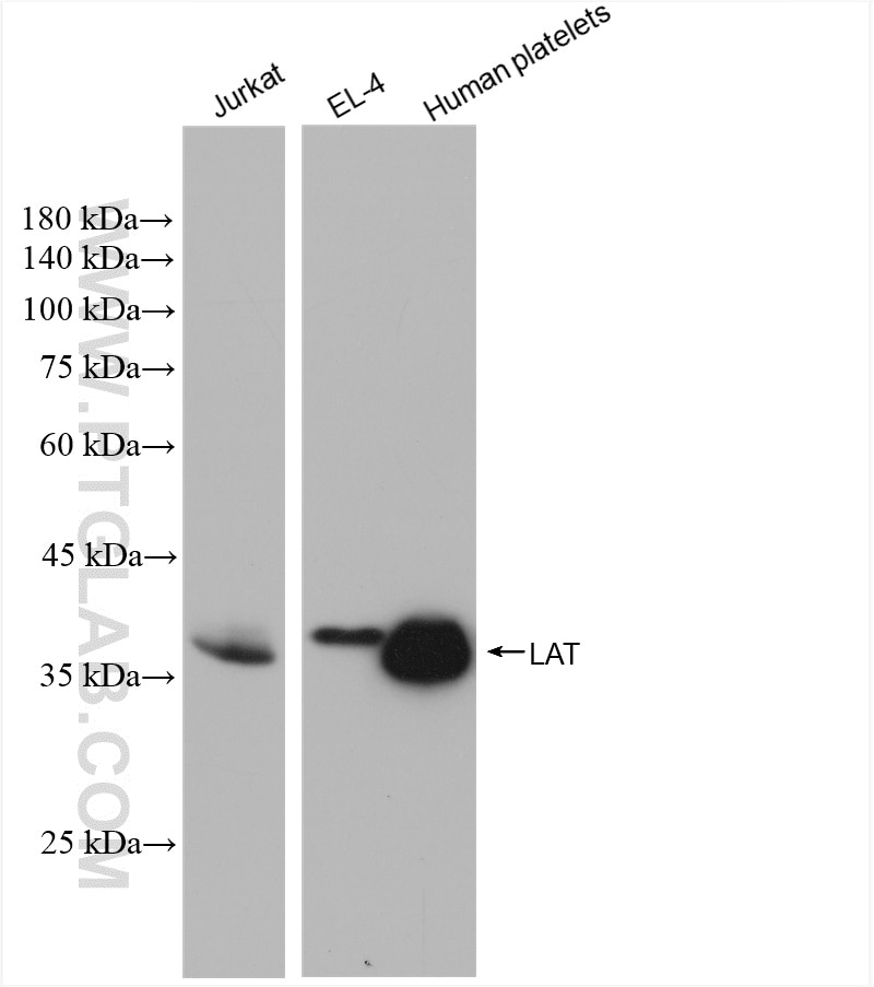 Western Blot (WB) analysis of various lysates using LAT Recombinant antibody (82901-1-RR)