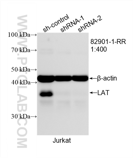 Western Blot (WB) analysis of Jurkat cells using LAT Recombinant antibody (82901-1-RR)