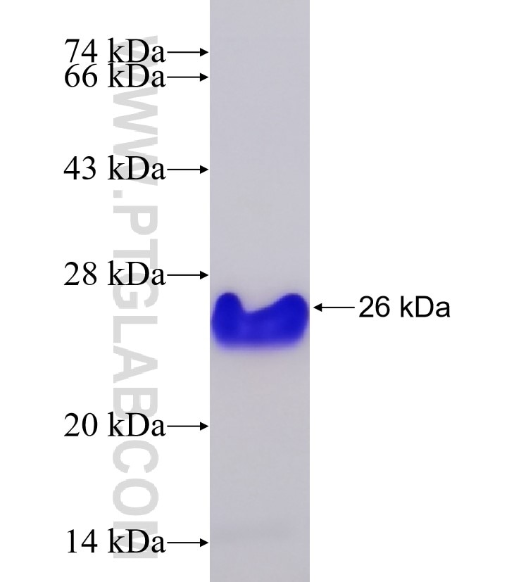 LAT fusion protein Ag33827 SDS-PAGE LAT fusion protein Ag33827 SDS-PAGE