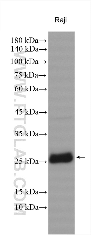 Western Blot (WB) analysis of various lysates using WBS15/LAT2 Polyclonal antibody (11008-1-AP)