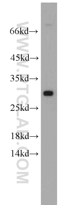 Western Blot (WB) analysis of human brain tissue using WBS15/LAT2 Polyclonal antibody (11008-1-AP)