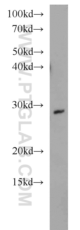 Western Blot (WB) analysis of human placenta tissue using WBS15/LAT2 Polyclonal antibody (11008-1-AP)