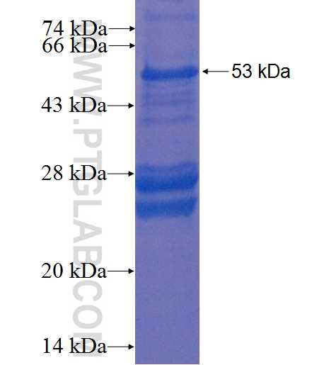 LAT2 fusion protein Ag1454 SDS-PAGE