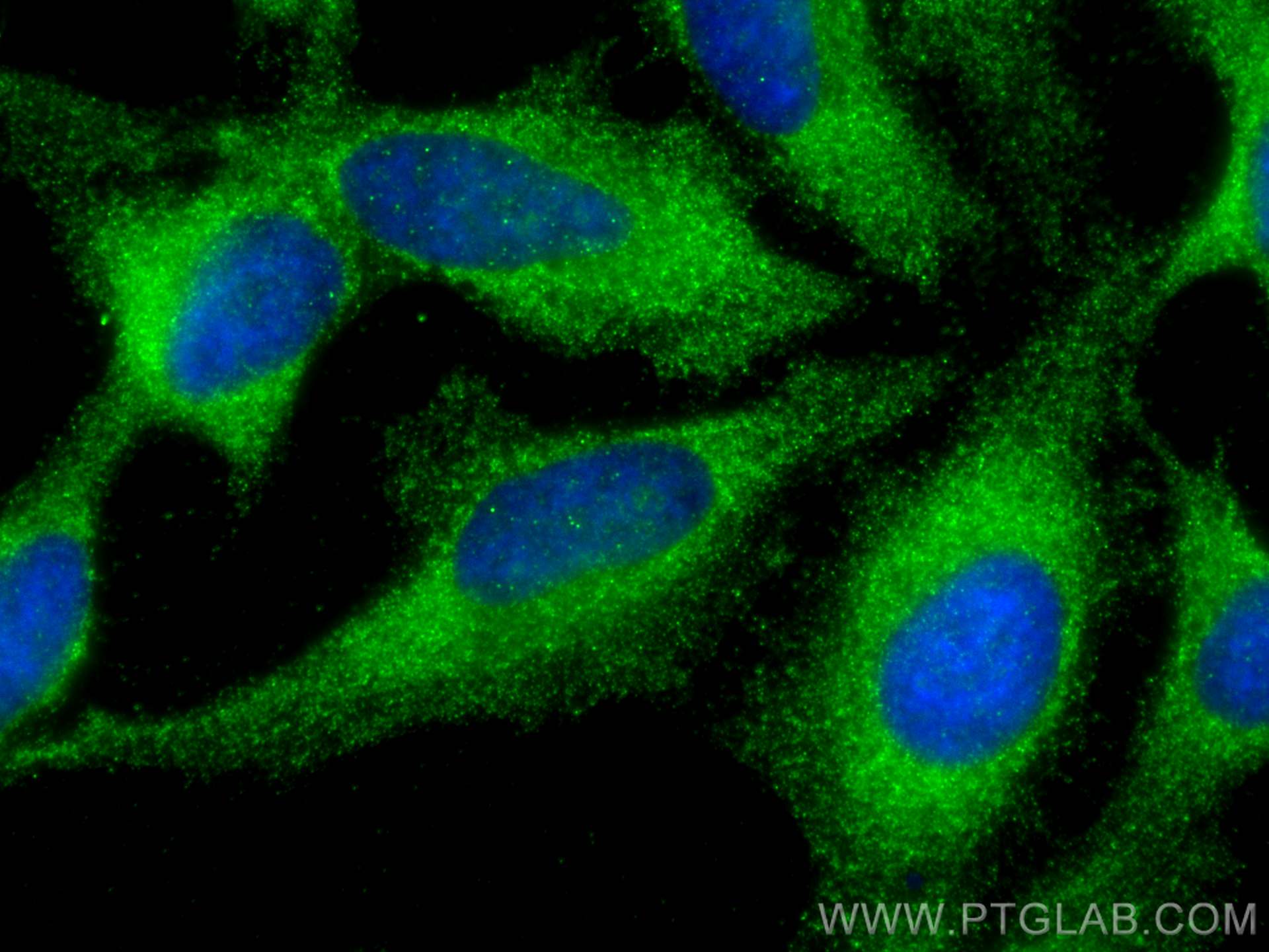 Immunofluorescence (IF) / fluorescent staining of HeLa cells using LATS1 Polyclonal antibody (17049-1-AP)
