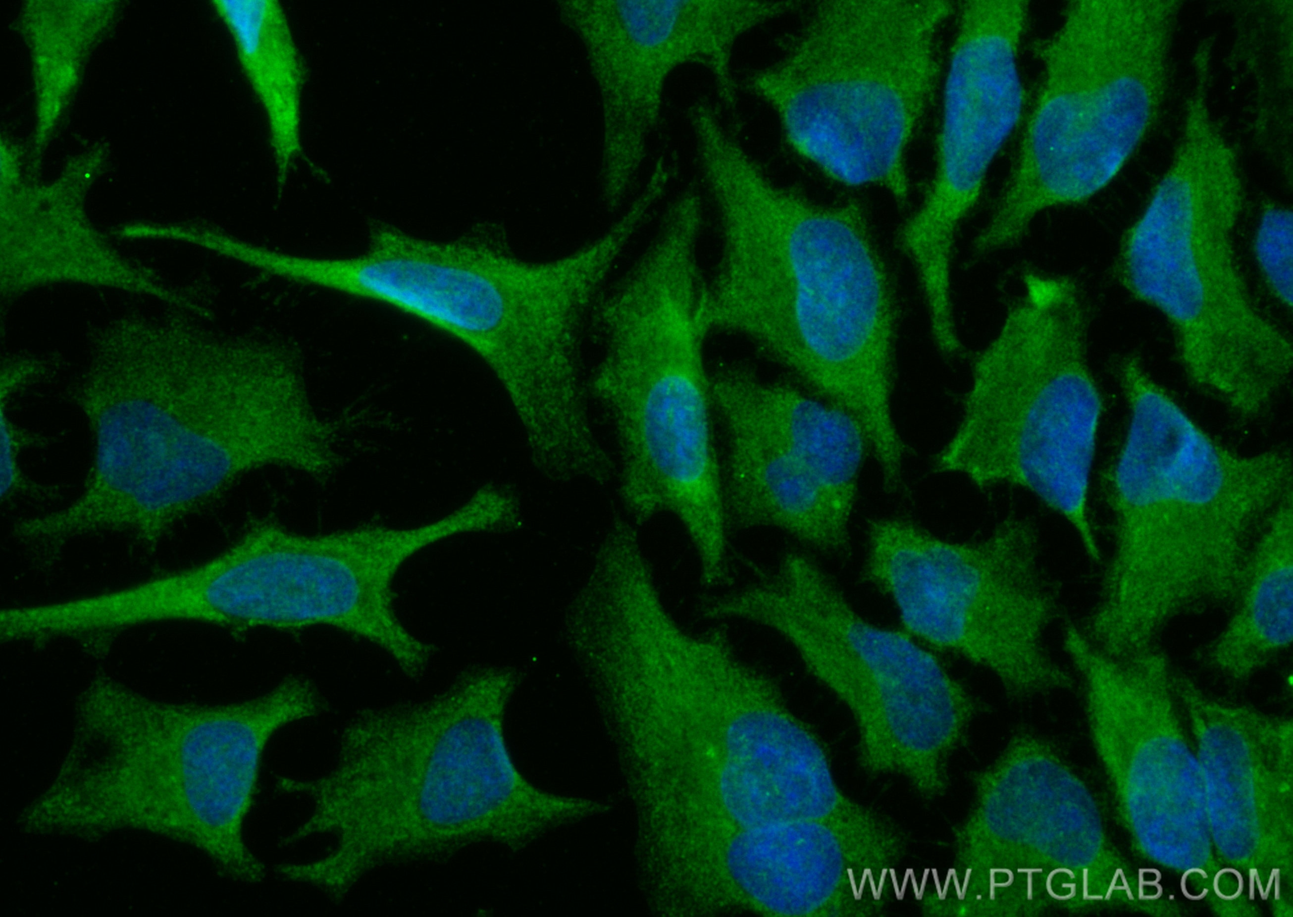 Immunofluorescence (IF) / fluorescent staining of HeLa cells using LATS1 Polyclonal antibody (17049-1-AP)