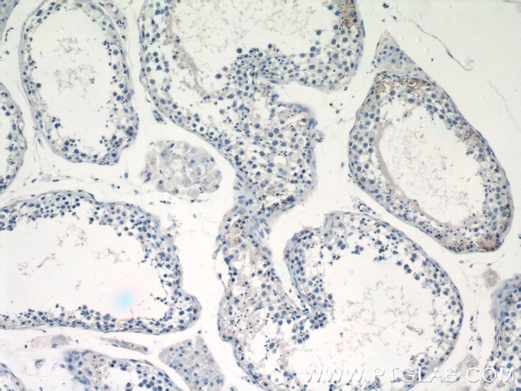 Immunohistochemistry (IHC) staining of human testis tissue using LATS1 Polyclonal antibody (17049-1-AP)