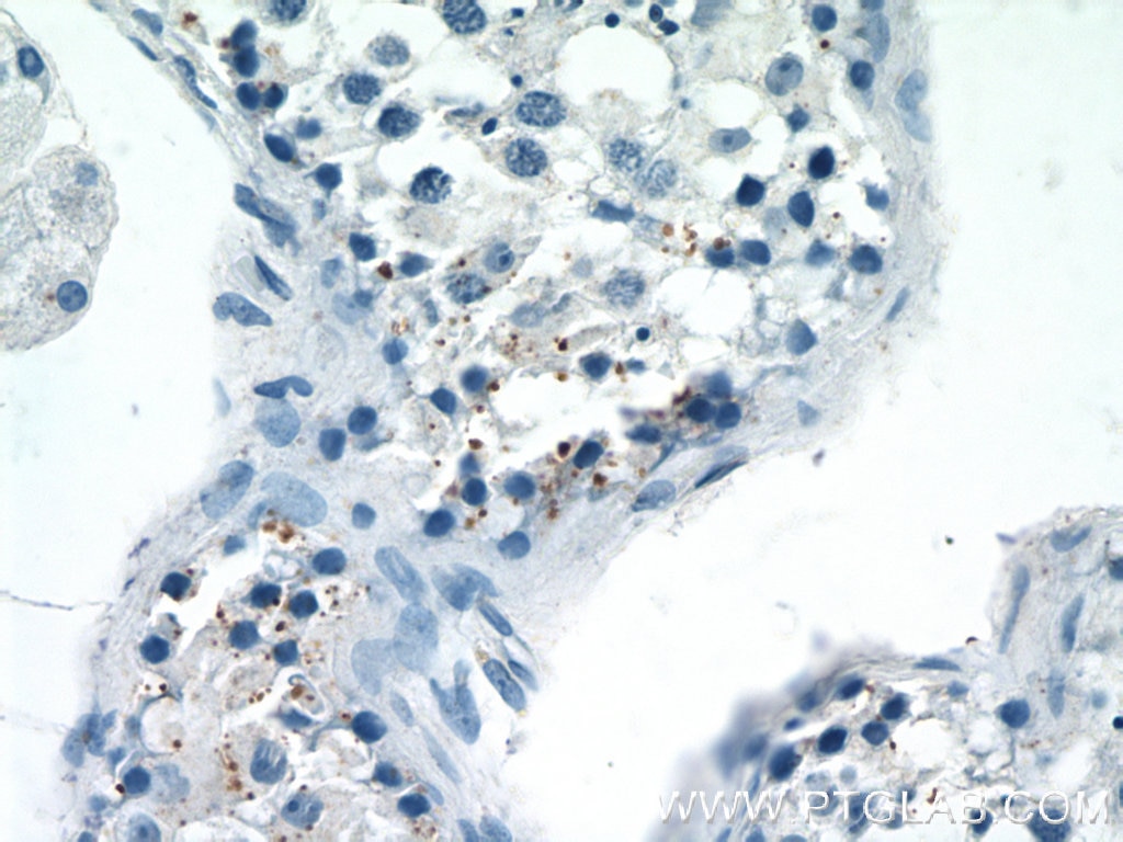 IHC staining of human testis using 17049-1-AP