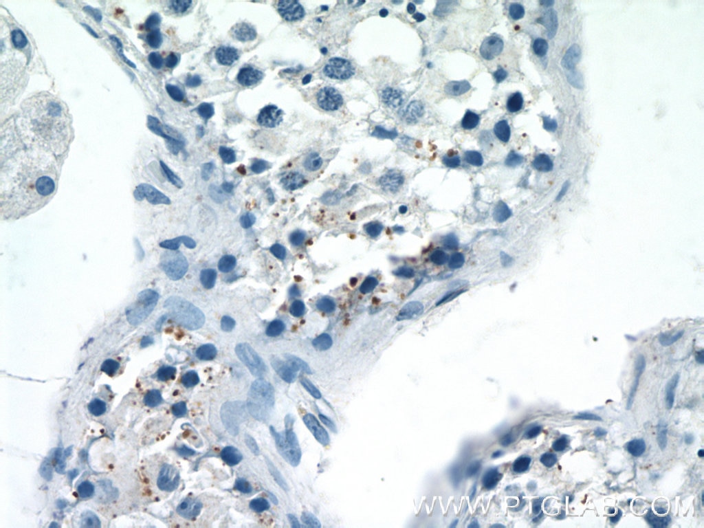 Immunohistochemistry (IHC) staining of human testis tissue using LATS1 Polyclonal antibody (17049-1-AP)