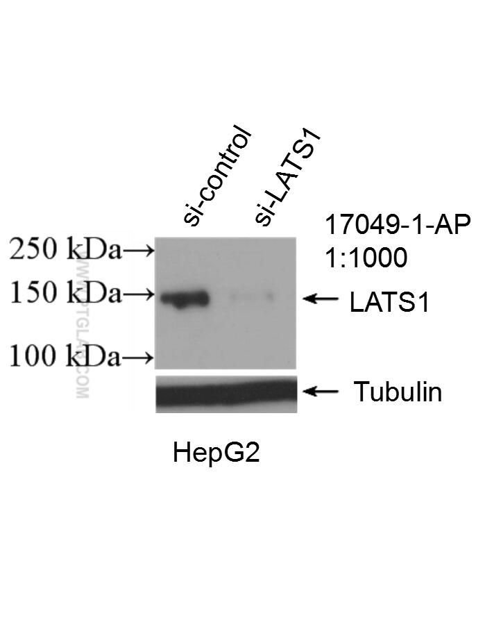 Western Blot (WB) analysis of HepG2 cells using LATS1 Polyclonal antibody (17049-1-AP)
