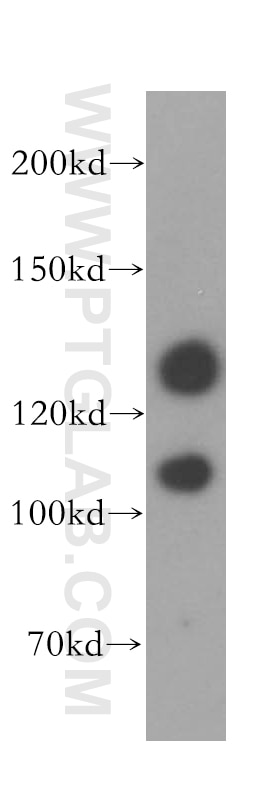 LATS1 Polyclonal antibody