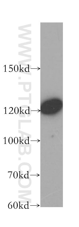 Western Blot (WB) analysis of K-562 cells using LATS1 Polyclonal antibody (17049-1-AP)