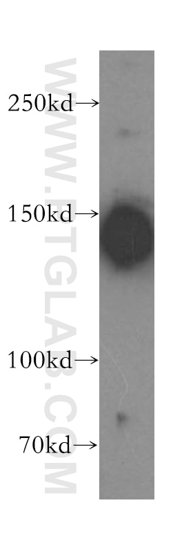 Western Blot (WB) analysis of SH-SY5Y cells using LATS1 Polyclonal antibody (17049-1-AP)