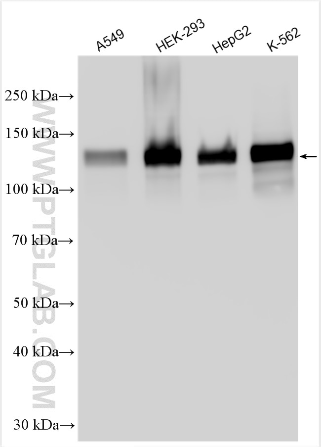 Western Blot (WB) analysis of various lysates using LATS1 Polyclonal antibody (30174-1-AP)