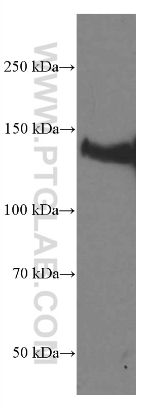 Western Blot (WB) analysis of HeLa cells using LATS1 Monoclonal antibody (66569-1-Ig)