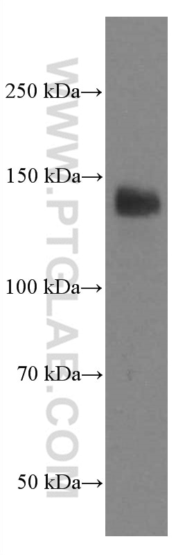 Western Blot (WB) analysis of HEK-293 cells using LATS1 Monoclonal antibody (66569-1-Ig)