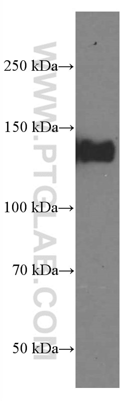 Western Blot (WB) analysis of HepG2 cells using LATS1 Monoclonal antibody (66569-1-Ig)