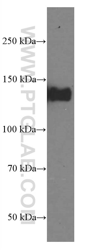 WB analysis of HepG2 using 66569-1-Ig